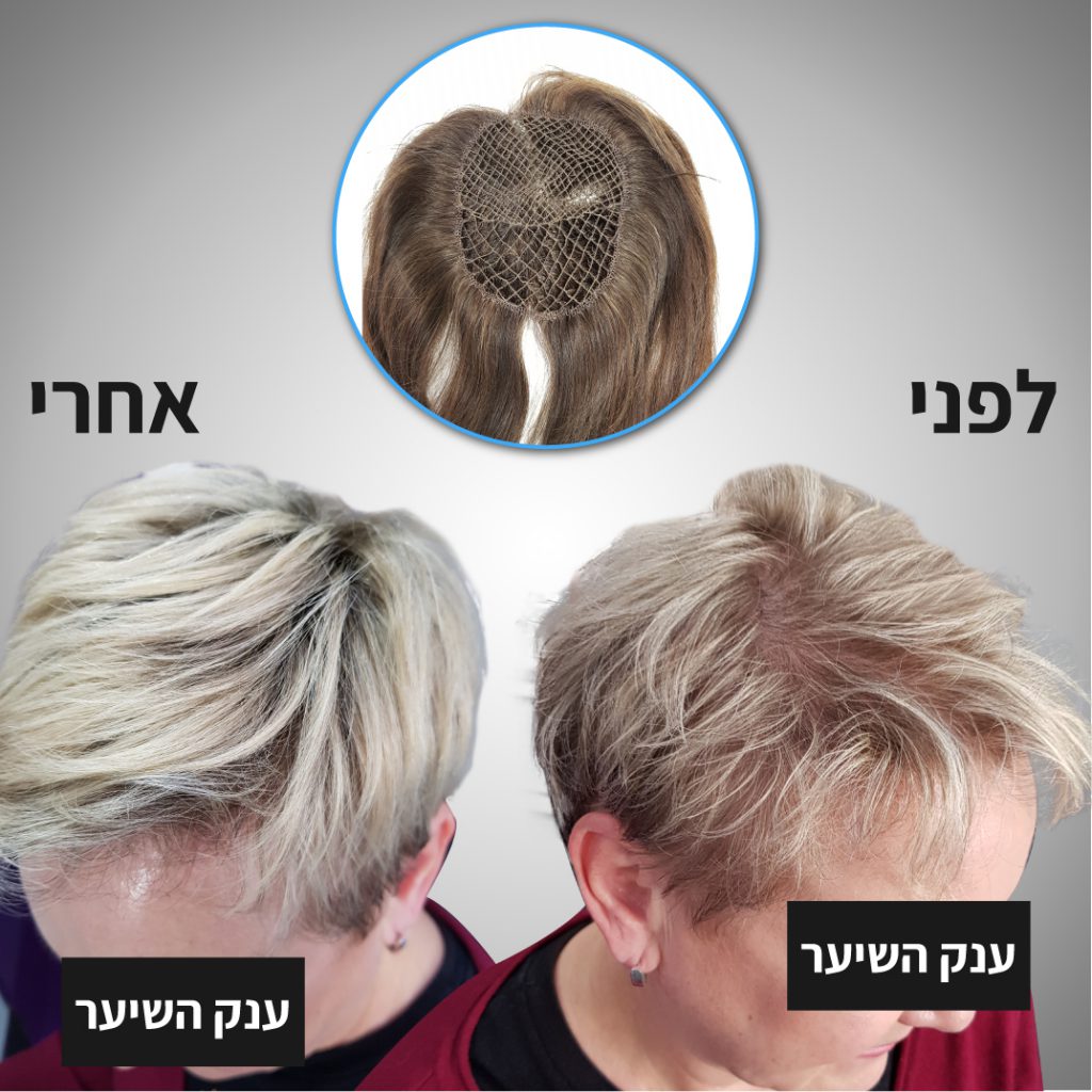 מילוי שיער דליל נשים